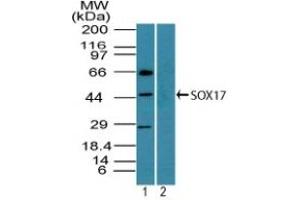 Image no. 1 for anti-SRY (Sex Determining Region Y)-Box 17 (SOX17) (AA 120-170) antibody (ABIN960351)