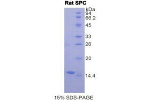 SDS-PAGE (SDS) image for Surfactant Protein C (SFTPC) (AA 95-194) protein (His tag) (ABIN1878164)