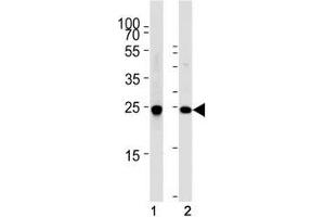 Western Blotting (WB) image for anti-Ubiquitin Carboxyl-terminal Esterase L1 (Ubiquitin Thiolesterase) (UCHL1) (AA 187-214) antibody (ABIN3029421)