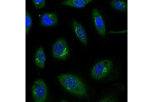 Immunofluorescence: This antibody stained HeLa cells.