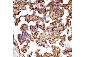 Anti- HSP27 antibody, IHC(F) IHC(F): Human Placenta Tissue (HSP27 抗体  (AA 1-205))