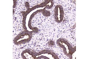 IHC analysis of 14-3-3 zeta/delta using anti-14-3-3 zeta/delta antibody . (14-3-3 zeta 抗体)