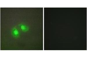 Immunofluorescence analysis of A549 cells, using TOP2A Antibody. (Topoisomerase II alpha 抗体  (AA 1-50))