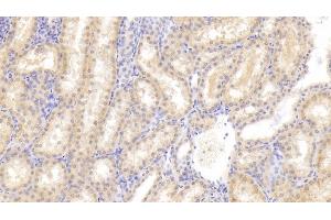 Detection of FIGN in Human Kidney Tissue using Polyclonal Antibody to Fidgetin (FIGN) (Fidgetin 抗体  (AA 1-308))