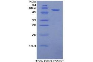 SDS-PAGE of Protein Standard from the Kit (Highly purified E. (Glucocorticoid Receptor ELISA 试剂盒)