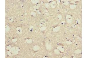 Immunohistochemistry of paraffin-embedded human brain tissue using ABIN7158053 at dilution of 1:100 (LINGO1 抗体  (AA 42-240))