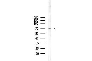 anti-Solute Carrier Family 25, Member 13 (Citrin) (slc25a13) (C-Term) antibody