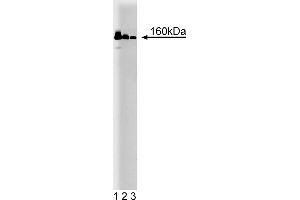 Western Blotting (WB) image for anti-MutS Homolog 6 (E. Coli) (MSH6) (AA 225-333) antibody (ABIN968248) (MSH6 抗体  (AA 225-333))
