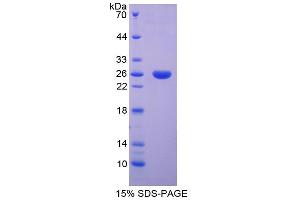 SDS-PAGE analysis of Rat SPB Protein. (SFTPB 蛋白)