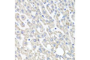 Immunohistochemistry of paraffin-embedded human liver injury using OTC antibody. (OTC 抗体)