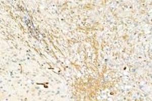 Immunohistochemistry analysis of paraffin-embedded mouse brain using,DMPK (ABIN7073790) at dilution of 1: 2000 (DMPK 抗体)