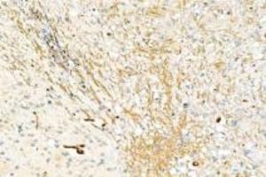 Immunohistochemistry analysis of paraffin-embedded mouse brain using,DMPK (ABIN7073790) at dilution of 1: 2000 (DMPK 抗体)