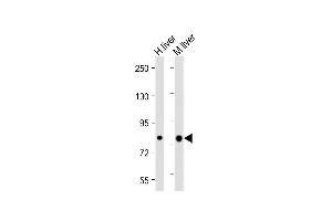 All lanes : Anti-ABCG1 Antibody (N-term) at 1:2000 dilution Lane 1: Human liver lysate Lane 2: Mouse liver lysate Lysates/proteins at 20 μg per lane.