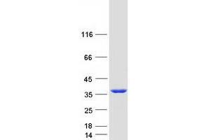 Western Blotting (WB) image for Survival Motor Neuron Domain Containing 1 (SMNDC1) protein (Myc-DYKDDDDK Tag) (ABIN2732252)