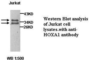 Image no. 1 for anti-Homeobox A1 (HOXA1) antibody (ABIN1577055) (HOXA1 抗体)