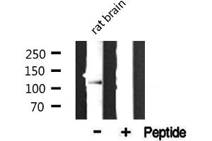 Western blot analysis of extracts from rat brain, using Collagen VI α2 antibody. (COL6A2 抗体  (Internal Region))