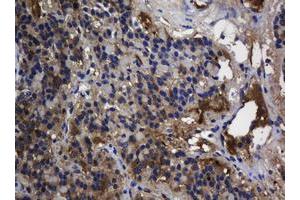 Image no. 2 for anti-TSC22 Domain Family, Member 1 (TSC22D1) antibody (ABIN1501537) (TSC22D1 抗体)