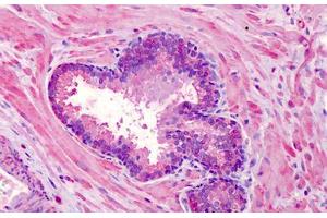 Immunohistochemistry (Formalin-fixed Paraffin-embedded Sections) (IHC (fp)) image for anti-Transient Receptor Potential Cation Channel, Subfamily M, Member 7 (TRPM7) (AA 1817-1863) antibody (ABIN605113)