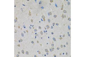Immunohistochemistry of paraffin-embedded mouse brain using PTK7 antibody. (PTK7 抗体)