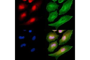 ABIN6265446 and ABIN6278639 staining  cells by IF/ICC. (TAL1 抗体  (C-Term))
