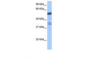 Image no. 1 for anti-Coilin (COIL) (AA 460-509) antibody (ABIN6738870) (Coilin 抗体  (AA 460-509))