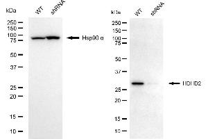 Western blotting analysis using HDHD2 antibody (ABIN7798834).