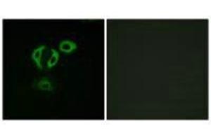 Immunofluorescence analysis of A549cells, using TACC3 antibody. (TACC3 抗体  (C-Term))