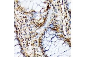 Immunohistochemistry of paraffin-embedded human colon using COPS3 Rabbit mAb (ABIN7266498) at dilution of 1:100 (40x lens). (COPS3 抗体)