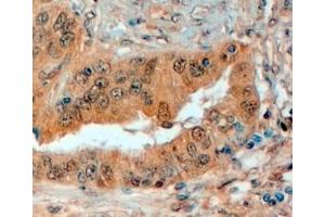 Immunohistochemistry (IHC) image for anti-Sema Domain, Immunoglobulin Domain (Ig), Short Basic Domain, Secreted, (Semaphorin) 3E (SEMA3E) (Internal Region) antibody (ABIN334487)