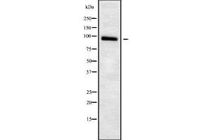 Western blot analysis of ADAM23 using Jurkat whole cell lysates