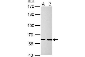 WB Image SOCS5 antibody detects SOCS5 protein by Western blot analysis. (SOCS5 抗体  (N-Term))