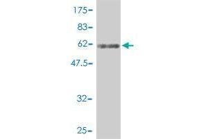 anti-DnaJ (Hsp40) Homolog, Subfamily B, Member 4 (DNAJB4) (AA 1-337) antibody