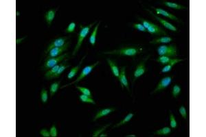 Immunofluorescence staining of Hela cells with ABIN7146926 at 1:266, counter-stained with DAPI. (Caspase 1 抗体  (AA 120-269))