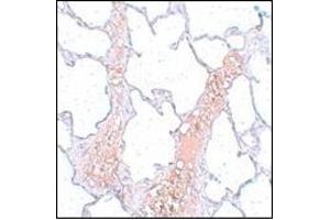 Immunohistochemistry of REEP2 in rat lung tissue with this product at 5 μg/ml. (REEP2 抗体  (Center))