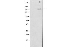 Western blot analysis of Bcr expression in K562 whole cell lysates,The lane on the left is treated with the antigen-specific peptide. (BCR 抗体  (N-Term))