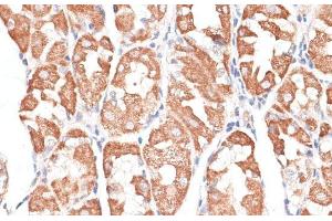 Immunohistochemistry of paraffin-embedded Human stomach using KIF4A Polyclonal Antibody at dilution of 1:100 (40x lens). (KIF4A 抗体)