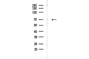 anti-Matrix Metallopeptidase 25 (MMP25) (Internal Region) antibody