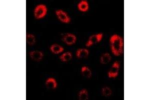 Immunofluorescent analysis of GILZ staining in U2OS cells. (TSC22D3 抗体)