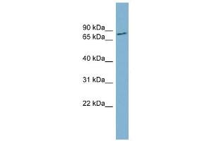 FURIN antibody used at 1 ug/ml to detect target protein. (FURIN 抗体)