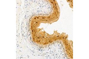 Immunohistochemistry of paraffin embedded mouse esophagus using SPRR3 (ABIN7075637) at dilution of 1:2000 (300x lens)