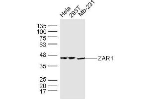 Human Hela, 293T, and Mb-231 cells probed with ZAR1 Polyclonal Antibody, unconjugated  at 1:300 overnight at 4°C followed by a conjugated secondary antibody at 1:10000 for 90 minutes at 37°C. (Zygote Arrest 1 抗体  (AA 351-424))