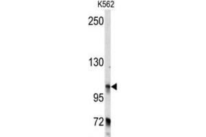Western Blotting (WB) image for anti-Bicaudal D Homolog 2 (BICD2) antibody (ABIN3003477) (BICD2 抗体)