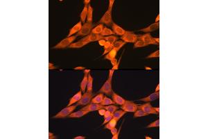 Immunofluorescence (IF) image for anti-Dynamin 1-Like (DNM1L) (AA 411-710) antibody (ABIN3023670)