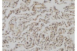 ABIN6273027 at 1/100 staining Human lung tissue by IHC-P. (ZCCHC11 抗体  (Internal Region))