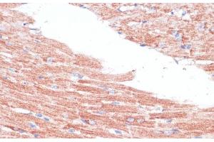Immunohistochemistry of paraffin-embedded Mouse heart using FZD4 Polyclonal Antibody at dilution of 1:100 (40x lens). (FZD4 抗体)