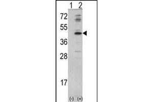 Western blot analysis of MVD (arrow) using rabbit polyclonal MVD Antibody (N-term) (ABIN390673 and ABIN2840969). (MVD 抗体  (N-Term))