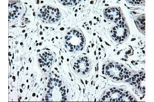 Immunohistochemical staining of paraffin-embedded breast tissue using anti-IRF3 mouse monoclonal antibody. (IRF3 抗体)