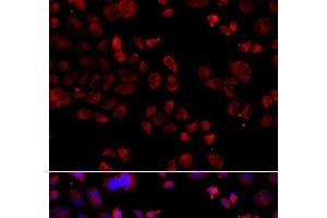 Immunofluorescence analysis of A549 cells using SLC22A11 Polyclonal Antibody (SLC22A11 抗体)
