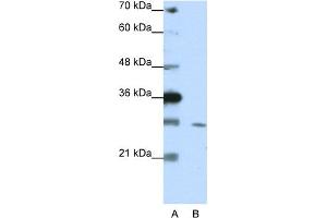WB Suggested Anti-ZNF397 Antibody Titration:  1. (ZNF397 抗体  (C-Term))