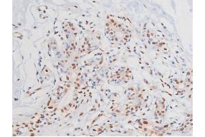 ABIN6267364 at 1/200 staining Human heart tissue sections by IHC-P. (KIT 抗体  (pTyr703))